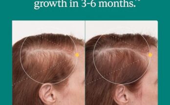 Nutrafol Women's Balance Hair Growth Reviews